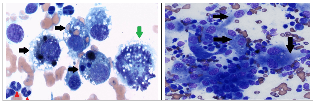 mast cell tumor dog cytology